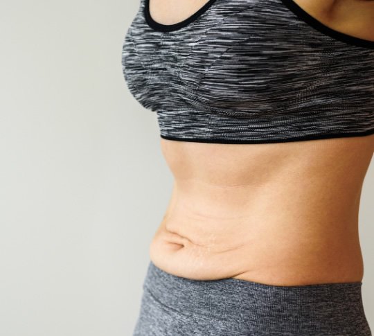 https://caurishealthfr.com/wp-content/uploads/2024/01/tummy-tuck.jpg